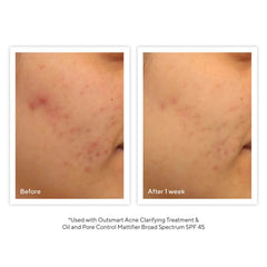 Murad Clarifying Cleanser 5.0 oz