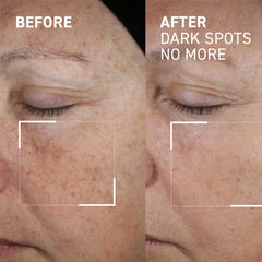 Dr. Brandt Dark Spots No More 15g