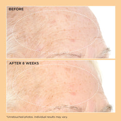 Perricone MD Neuropeptide Pro-Strength Firming Moisturizer