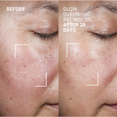 Dr. Brandt Glow Overnight Retinol Oil 30ml