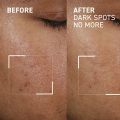 Dr. Brandt Dark Spots No More 15g
