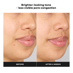 Paula's Choice Skin Perfecting 4% BHA Advanced Exfoliating Serum Toner 30ml
