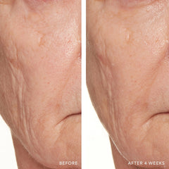 Lancer Skincare The Method: Polish Normal-Combination Skin (4.2 fl. oz.)