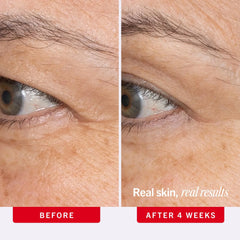 First Aid Beauty Ultra Repair Retinol Eye Cream 0.5 oz