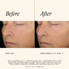 SkinMedica Even and Correct Brightening Treatment Pads - 60 Pads