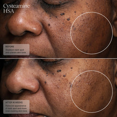 SENTÉ Pigment and Tone Corrector with FREE 15ml Dermal Repair Cream