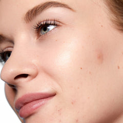 Peace Out Salicylic Acid Acne Day Dots (20 Dots)