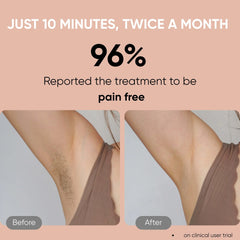 Sensica Sensilight Pro Cordless IPL