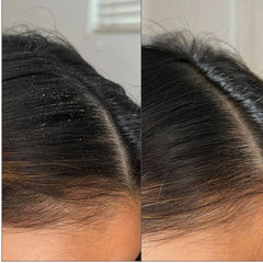 Briogeo Scalp Revival™ Charcoal + Tea Tree Buildup Detox Spray 4 oz