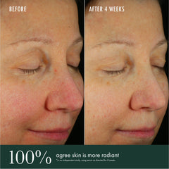 RéVive Skincare Brightening Vitamin C Serum 30ml