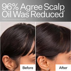 Act+Acre 4% Niacinamide Oily Scalp Serum 2.2 oz