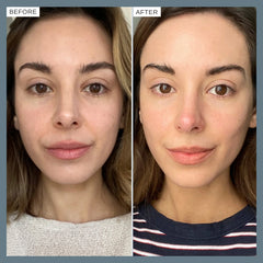 Alpha-H Vitamin C Serum with 10% Ethyl Ascorbic Acid 25ml