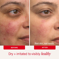 First Aid Beauty Ultra Repair Cream (2oz)