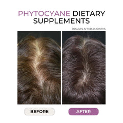 Phyto PHYTOCYANE Dietary Supplement