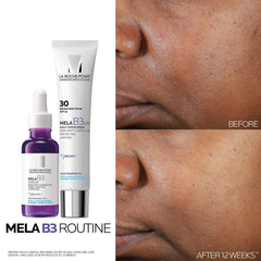 La Roche-Posay Mela B3 Dark Spot Serum With Melasyl™ and Niacinamide (Various Sizes)