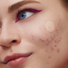 Peace Out 2% Salicylic Acid Early Stage Acne Dot (8 Dots)
