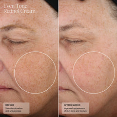 SENTÉ Even Tone Retinol Cream 30ml