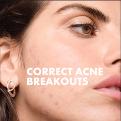 Vichy Normaderm 3-Step Acne Kit for Oily Skin ($103 Value)