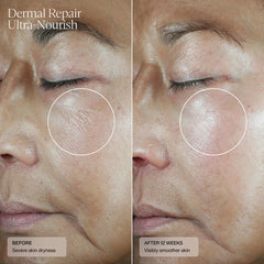 SENTÉ Dermal Repair UltraNourish (1.7 oz.)