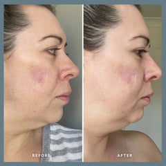 Alpha- H Vitamin A Serum with 0.3% Retinol + 1% Bio-Retinoid 25ml