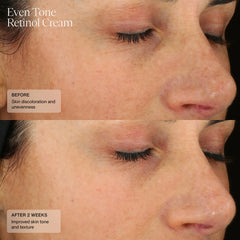 SENTÉ Even Tone Retinol Cream 30ml