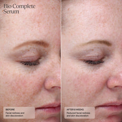 SENTÉ Bio Complete Serum (1 oz.)