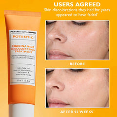 Peter Thomas Roth Potent-C Niacinamide Discoloration Treatment 50ml