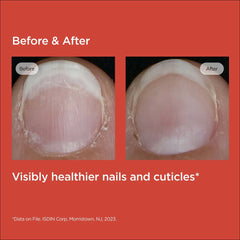 ISDIN Si-Nails Strengthening Nail Serum