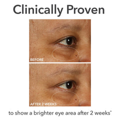 Dr Dennis Gross Skincare DermInfusions Fill + Repair Eye Cream 15ml