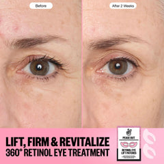 Peace Out Retinol 360° Eye Lift Patches to Lift, Firm and Revitalize Eyes (5 Pairs)