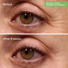 Murad Retinol Youth Renewal Eye Serum 0.5 oz