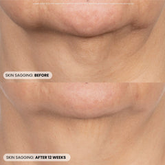 Dr. Whitney Bowe Beauty P46 Peptide + HA Plumping Serum