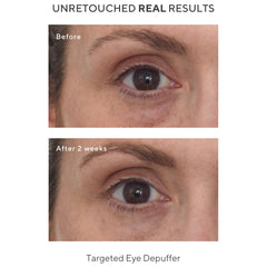 Murad Targeted Eye Depuffer 0.5 oz