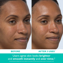 Peter Thomas Roth Even Smoother™ Instant Reveal Facial Peel (8 Cotton Swabs)