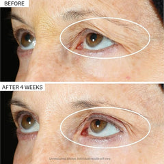 StriVectin Peptight 360˚ Tightening Eye Serum (1 fl. oz.)
