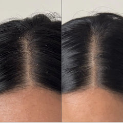 Briogeo Scalp Revival™ Charcoal + Tea Tree Buildup Detox Spray 4 oz