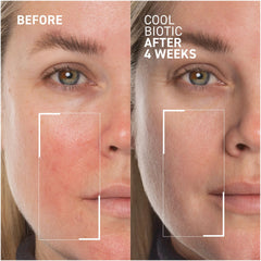 Dr. Brandt Cool Biotic Pre-Biotic Redness Relief Cream 1.7oz