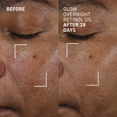 Dr. Brandt Glow Overnight Retinol Oil 30ml