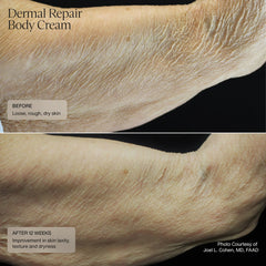 SENTÉ Dermal Repair Body Cream 177ml
