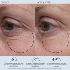 Dr. Loretta Tightening Eye Gel (20 ml.)