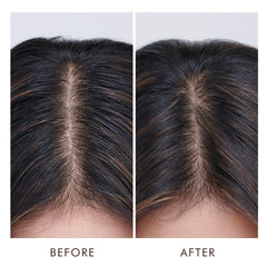 Moroccanoil Oily Scalp Treatment 1.5 oz