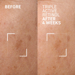 Dr. Brandt Triple Active Retinol 30g