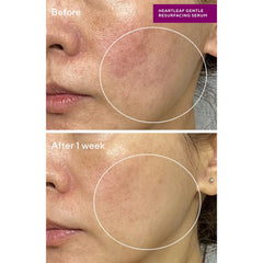 Murad Sensitive Skin Heartleaf Gentle Resurfacing Serum 30ml
