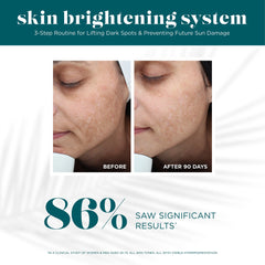 VI Derm Skin Brightening 3-Piece System (Worth $274.00)