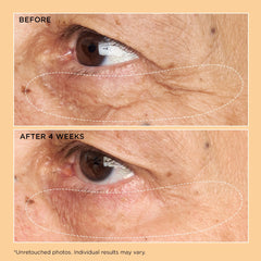 Perricone MD Neuropeptide Corrective Brightening Under-Eye Cream