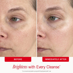 First Aid Beauty Brighten + Glow Exfoliating Gel Cleanser - 6.0 oz