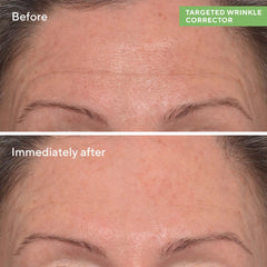 Murad Targeted Wrinkle Corrector 0.5 oz