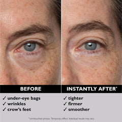 Peter Thomas Roth Instant FIRMx Eye (1 fl. oz.)