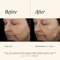 SkinMedica TNS® Advanced+ Serum (1 fl. oz.)