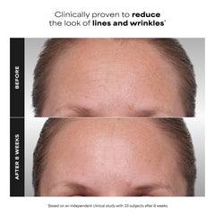 Paula's Choice CLINICAL 1% Retinol Treatment (1 fl. oz.)